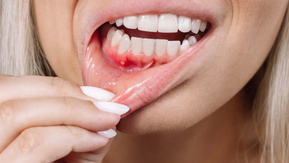 The Link Between Gum Disease and Heart Disease